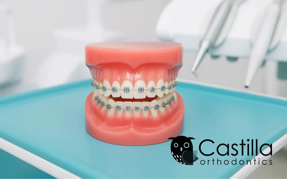 image - What to Expect at Your First Orthodontic Consultation at Castilla Orthodontics